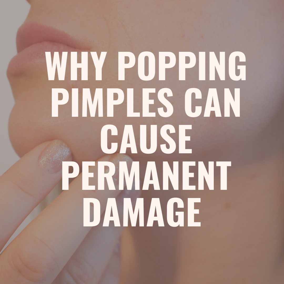 Why Popping Pimples and Picking Your Skin Can Cause Long-Term Damage