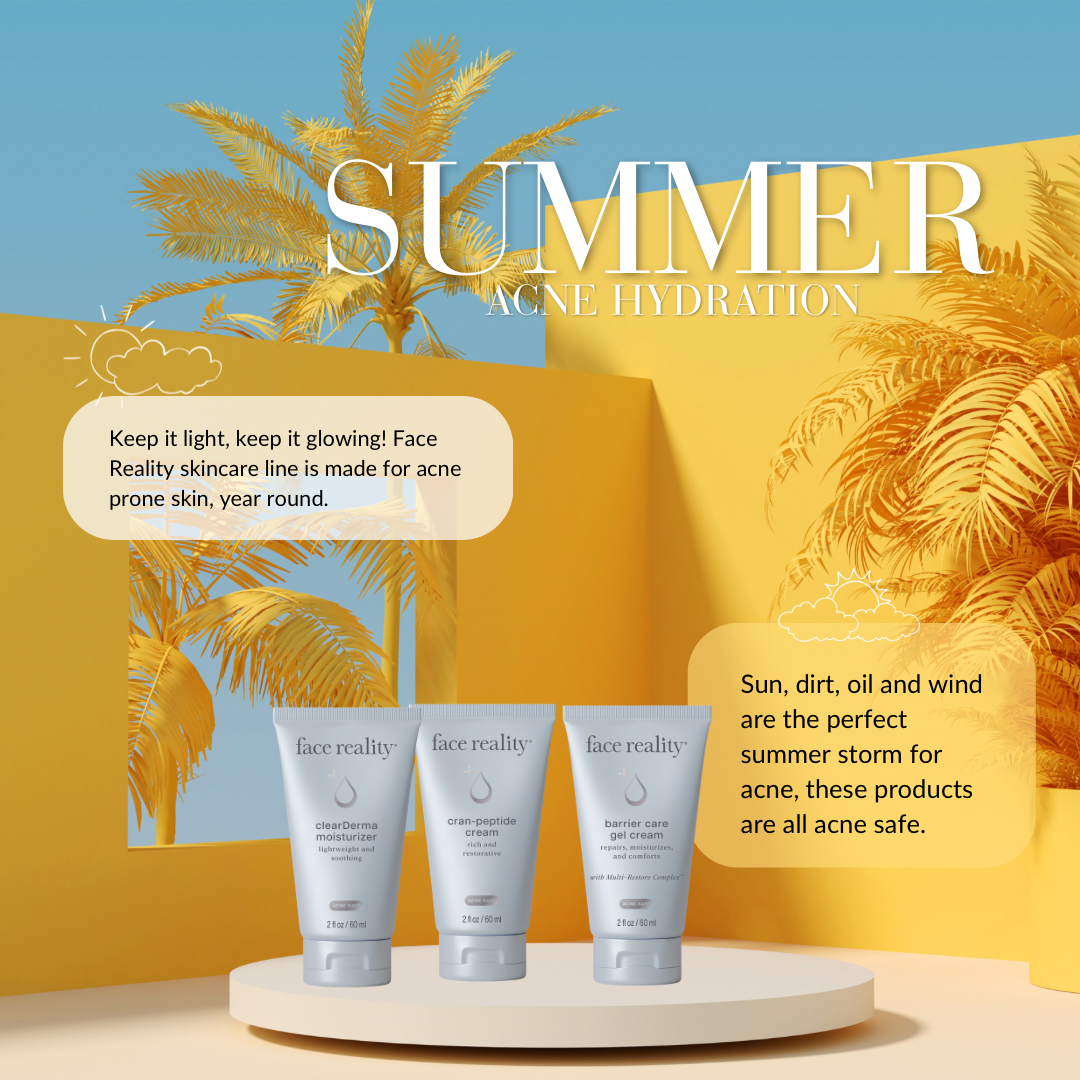 Hydrating the skin in summer, while dealing with acne