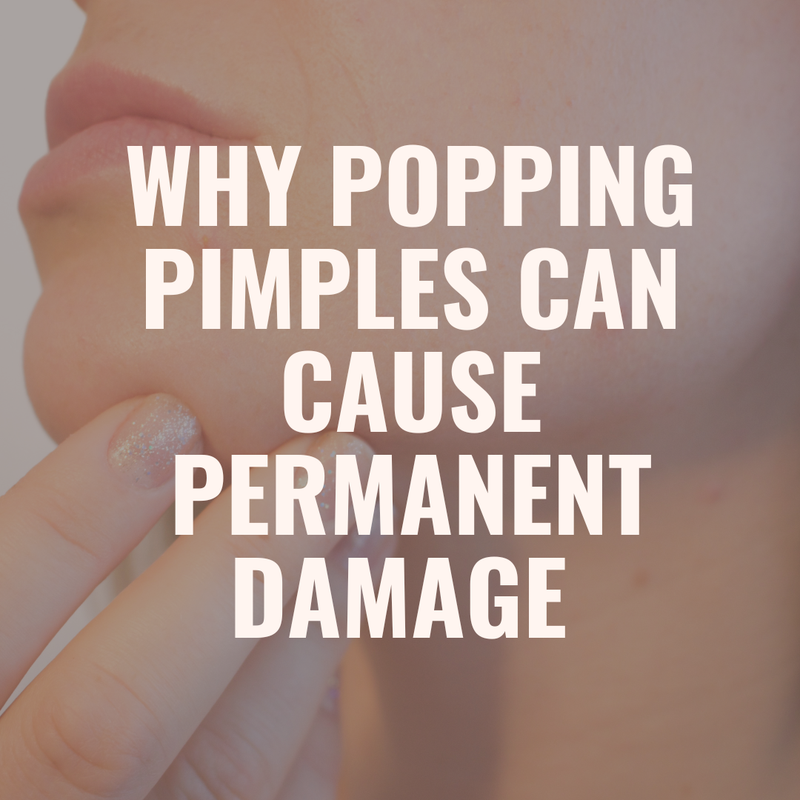 Why Popping Pimples and Picking Your Skin Can Cause Long-Term Damage