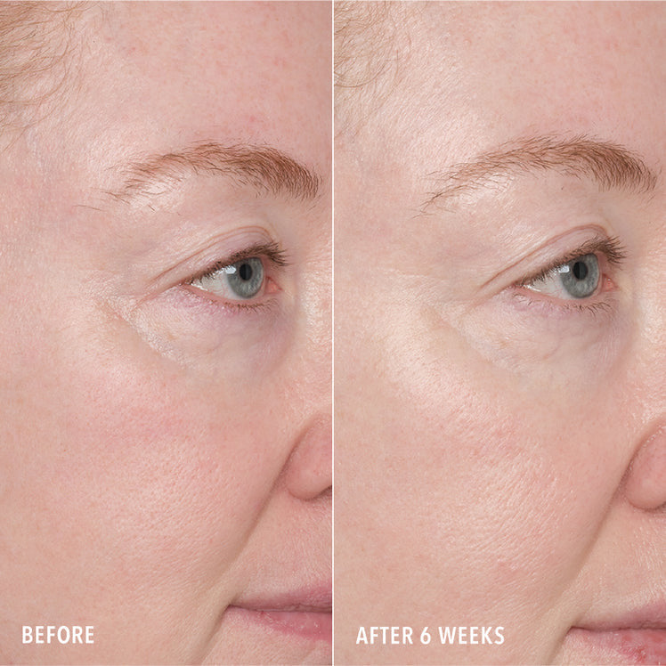 Surface and Repair Peptide Pads